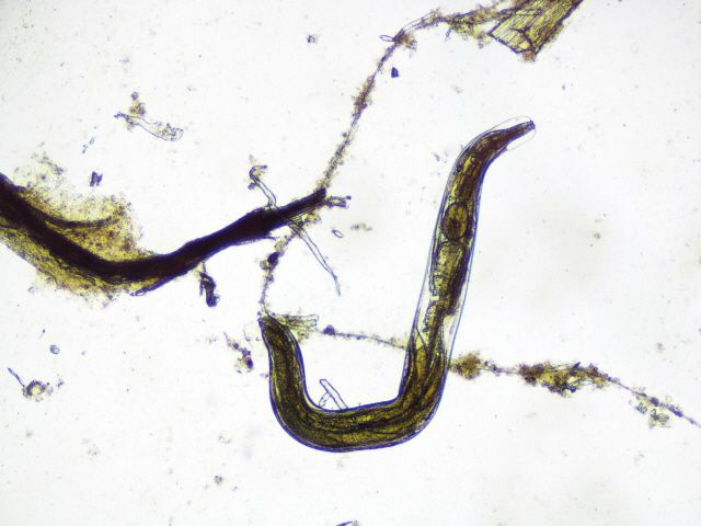 antonioebiagioecesarearrigoenterobiusvermicularislarvaadulta