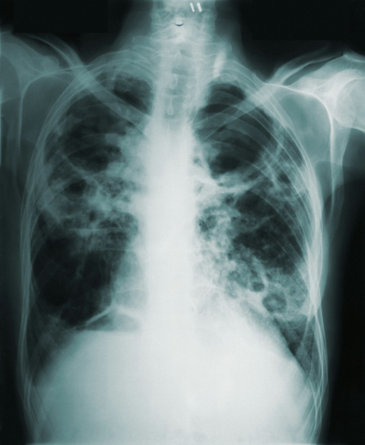 cdc-4u6qzwnu-ns-unsplash