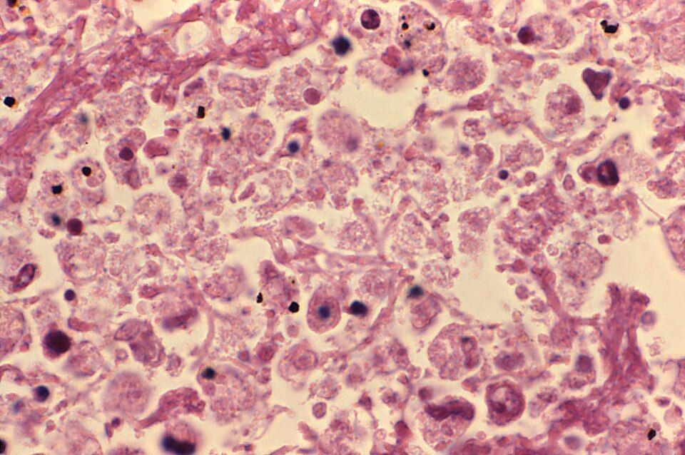 lungtissueduringlegionellosis